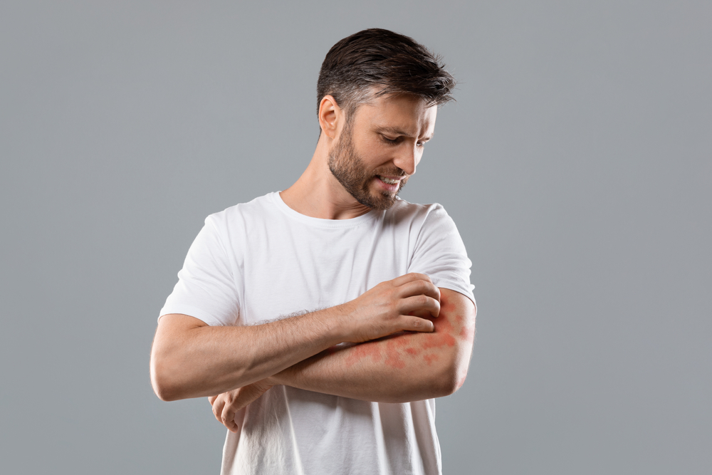 man with skin rash on arm